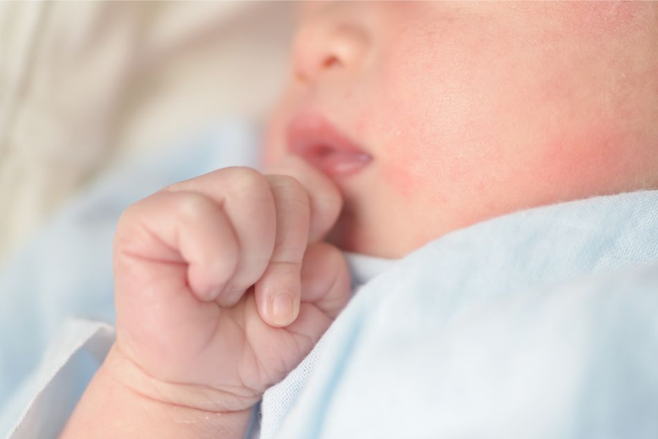 Reconhecer as alergias nos bebés: sintomas e tratamento